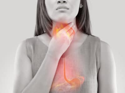 Mujer acidez ardor estomago reflujo gastroesofagico