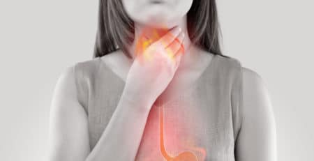 Mujer acidez ardor estomago reflujo gastroesofagico